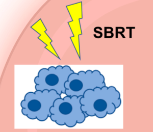 SBRT chart